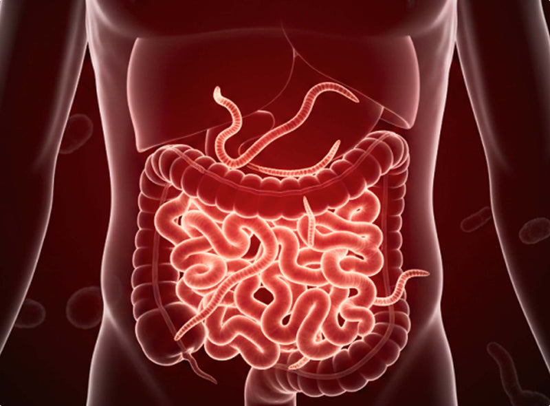 El verdadero problema podría estar
escondido en lo más profundo de tu intestino